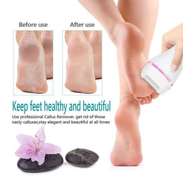 Rechargeable Electric Foot File & Callus Remover