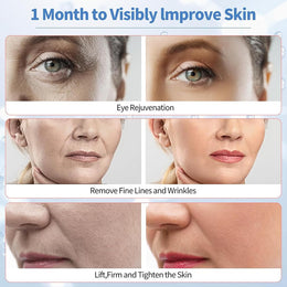 6-in-1 Microcurrent Facial Toning & Massage Device