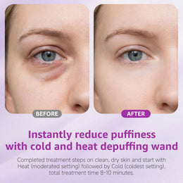 Depuffing Wand for Eyes & Face, 2-in-1 Cold & Heat Eye & Facial Massager