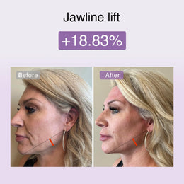 4-in-1 Microcurrent & Red Light Facial Toning Device