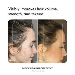 4-in-1 Warming Scalp Massage & Hair Care Brush Set