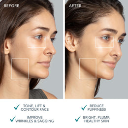 Microcurrent Facial Lifting & Toning Device